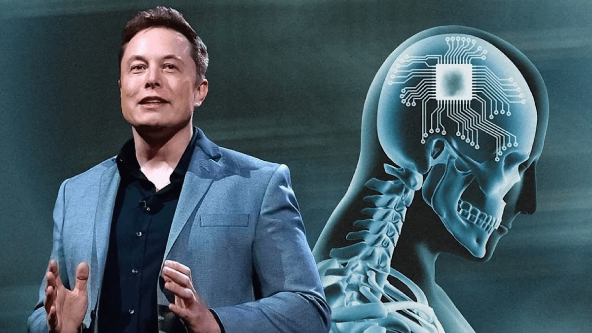 Elon Musk annonce le succès de la première implantation d'une puce cérébrale dans la tête d'un être humain.