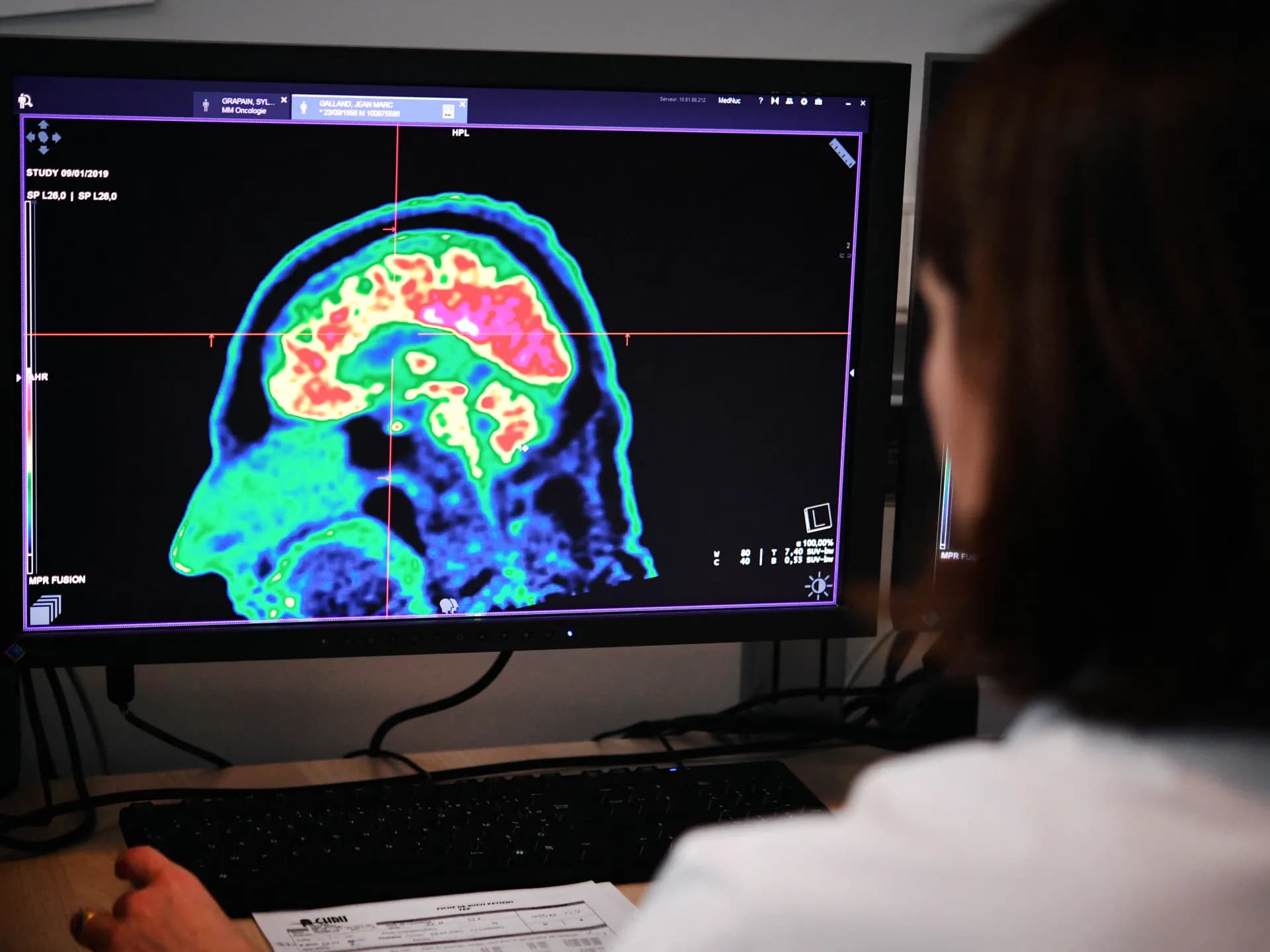 Une étude rassurante : Aucun lien entre l'utilisation des téléphones portables et l’incidence du cancer du cerveau