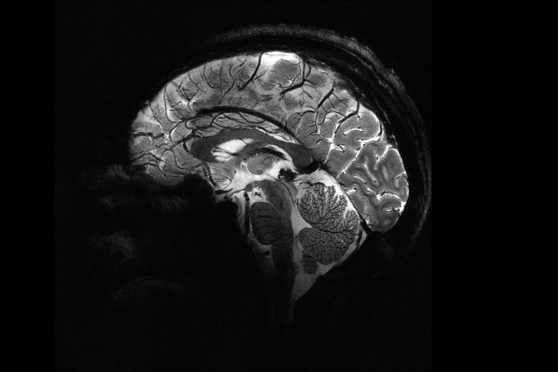 La France dévoile la photographie la plus précise du cerveau humain