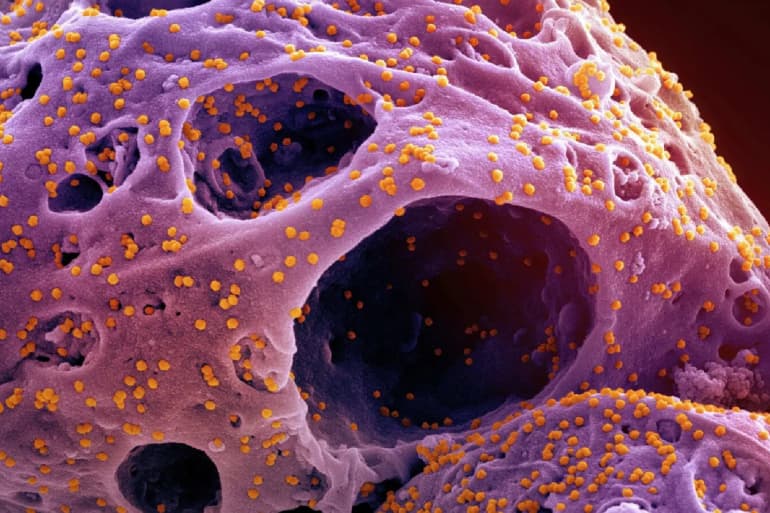 Les virus zombies… une pandémie enfouie sous la glace depuis des milliers d'années