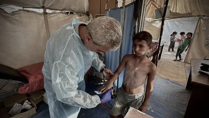 Maladies épidémiques qui « brûlent la peau » et tuent des enfants dans les camps de déplacés au sud de Gaza