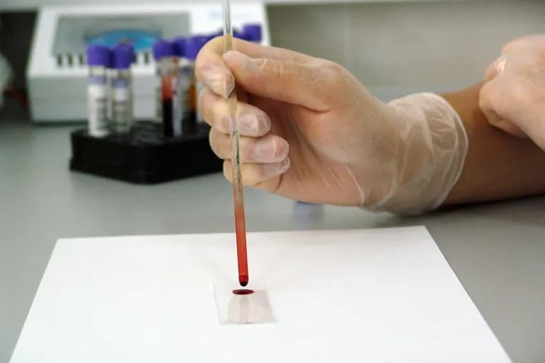 Une goutte de sang peut tester plusieurs maladies en quelques minutes seulement