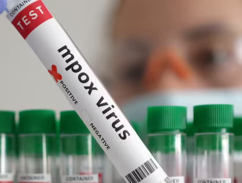 Mpox-Nigeria : premier pays à recevoir 10 000 doses de vaccins