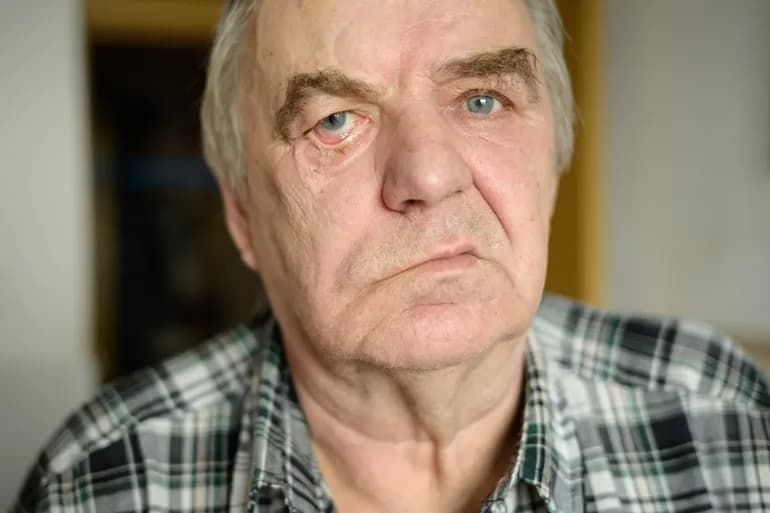 Qu’est-ce que la paralysie faciale périphérique ?