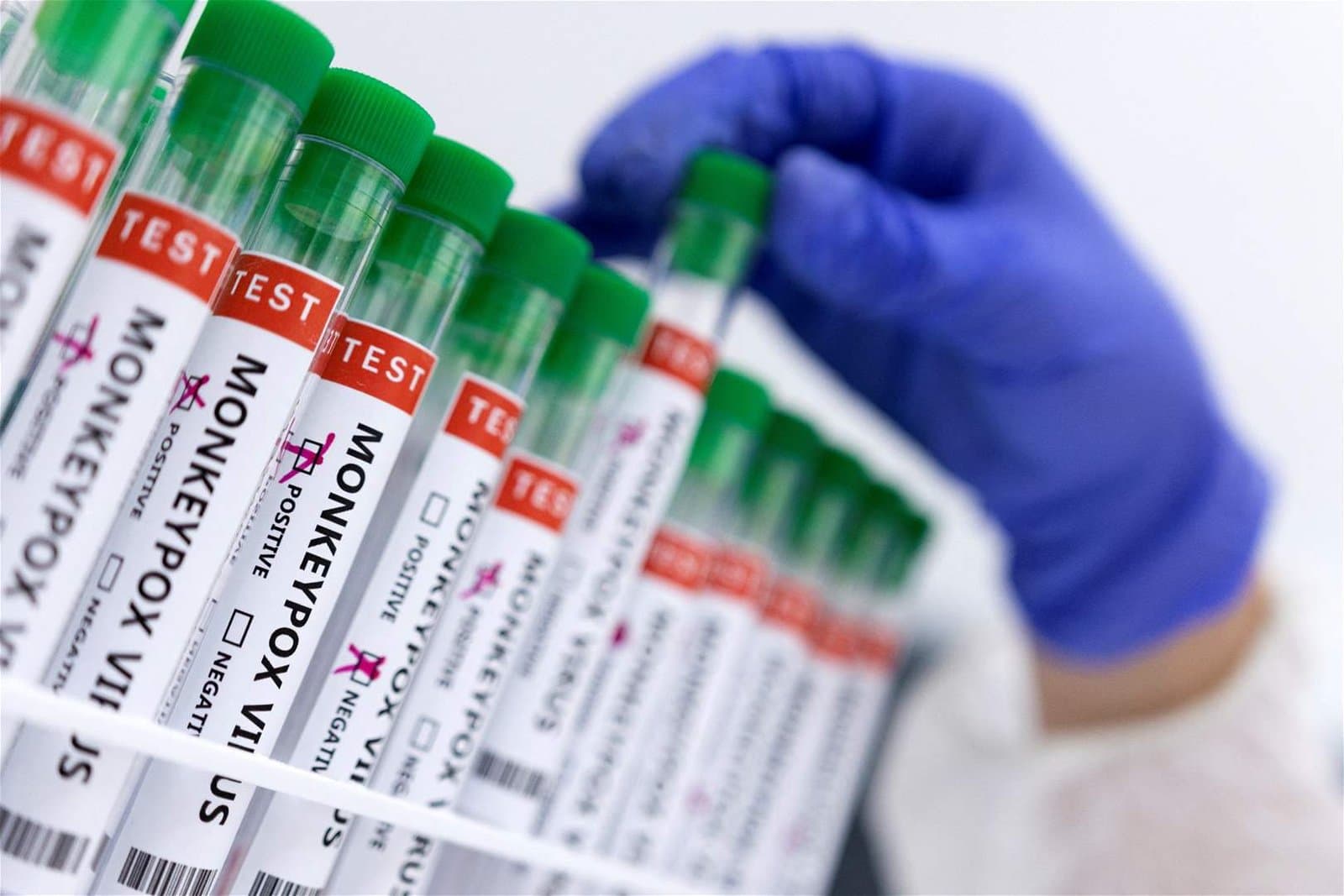 Un nouveau variant du virus du monkeypox détecté en Allemagne