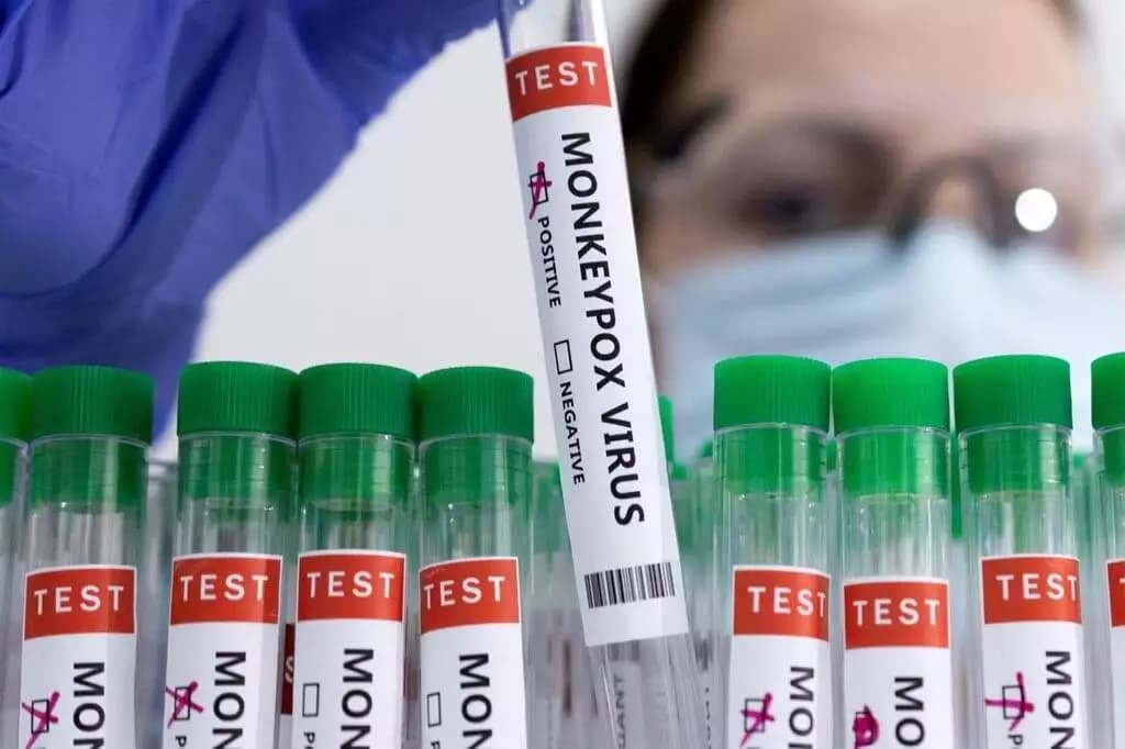 Mpox : 1er cas détecté au Canada