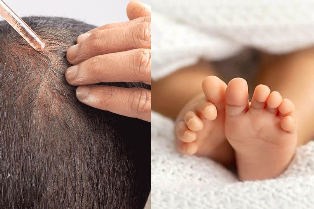Plusieurs cas en Espagne: le mystère des "bébés loups-garous" enfin résolu