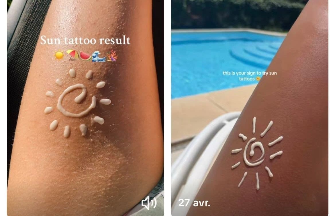 Sun Tattoo: mode estivale ou menace invisible pour la peau ?