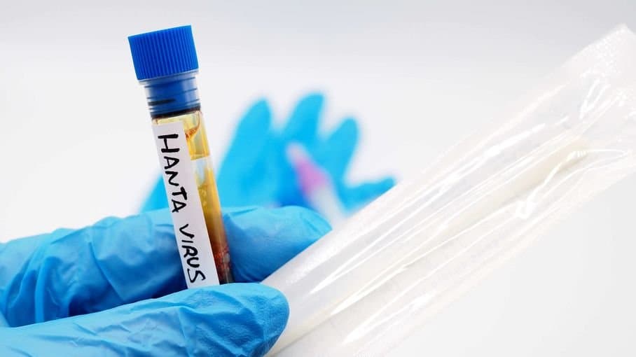 Hantavirus: Alerte dans un hôpital néerlandais