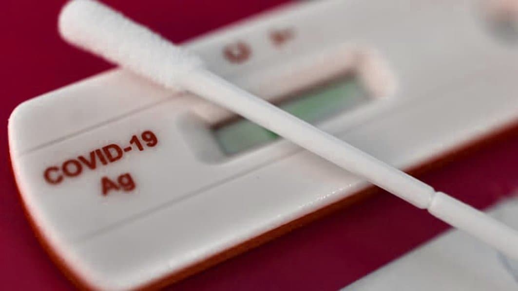 COVID-19 : réactivation du programme de veille et de riposte par le ministere de la santé (circulaire)
