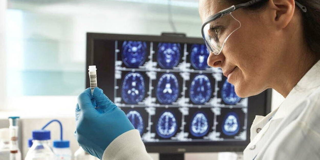 Les scientifiques américains découvrent un traitement contre la maladie d'Alzheimer