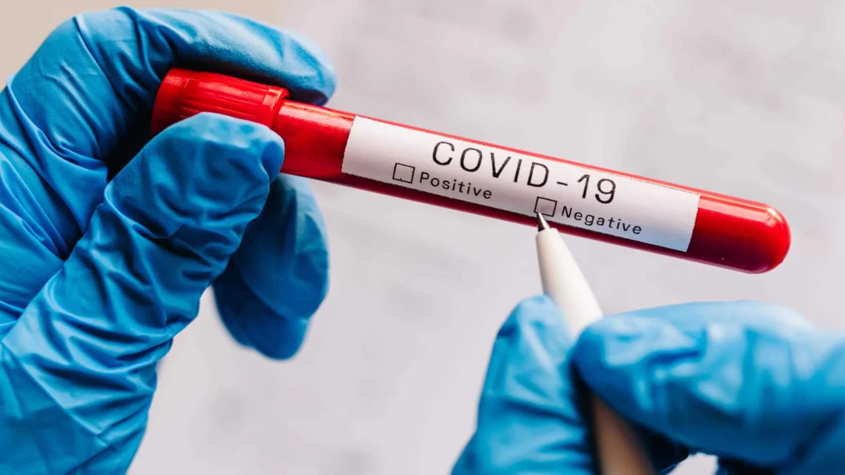 COVID-19 au Maroc : 12 nouvelles infections et aucun décès enregistrés en une semaine